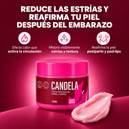 Reduce las estrías y reafirma tu piel después del embarazo